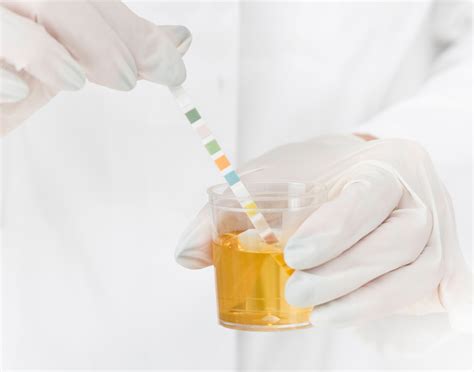 How a Urine pH Test Helps in the Diagnosis of Disease .
